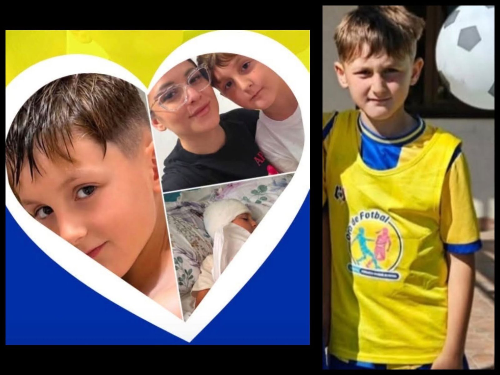 Apel disperat pentru Mattias, un copil de 8 ani din Buzău: comunitatea se mobilizează cu donații și licitații caritabile